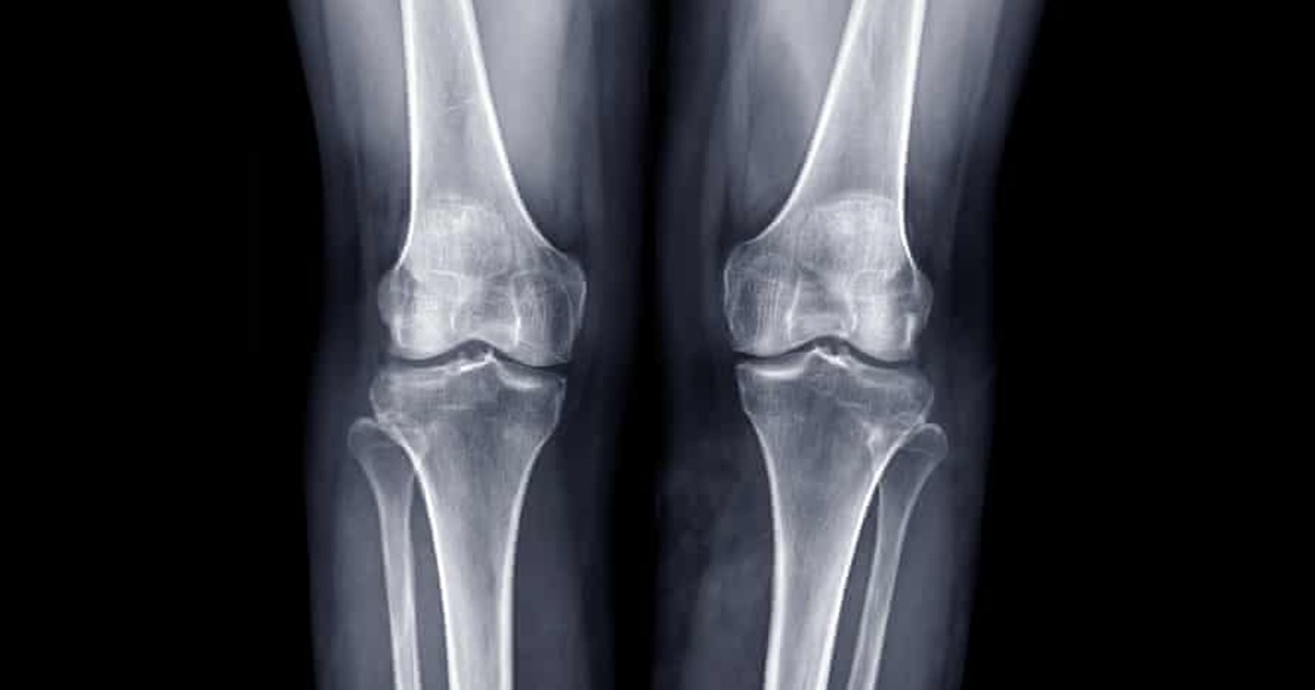 34356fb0cade90238e348b1a4fe2b75a83b0dd1f