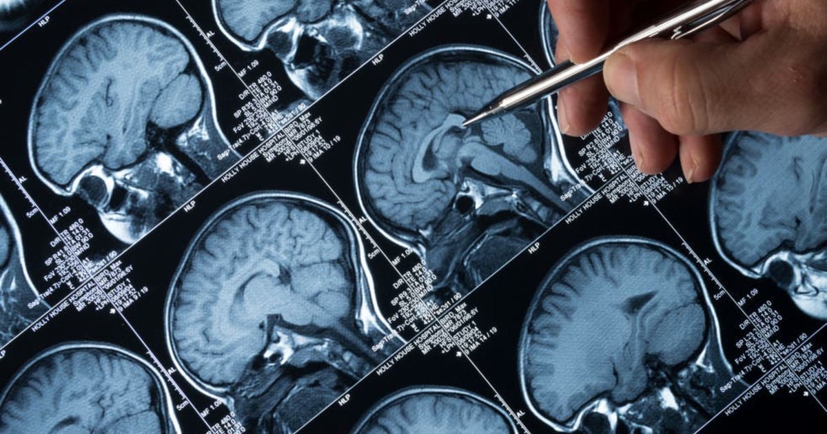 a1cc6f66dae40ab69c687ef1846a880b5a78bccd