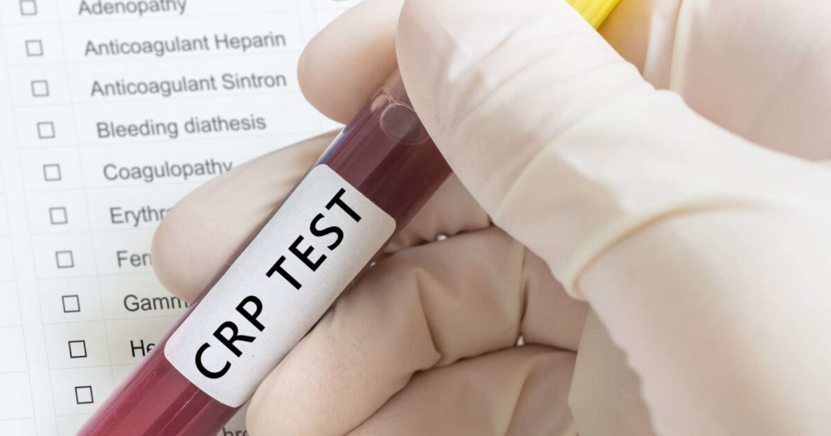 6fe8701fa95b5c537ab9e68dd5b978c77af0e837