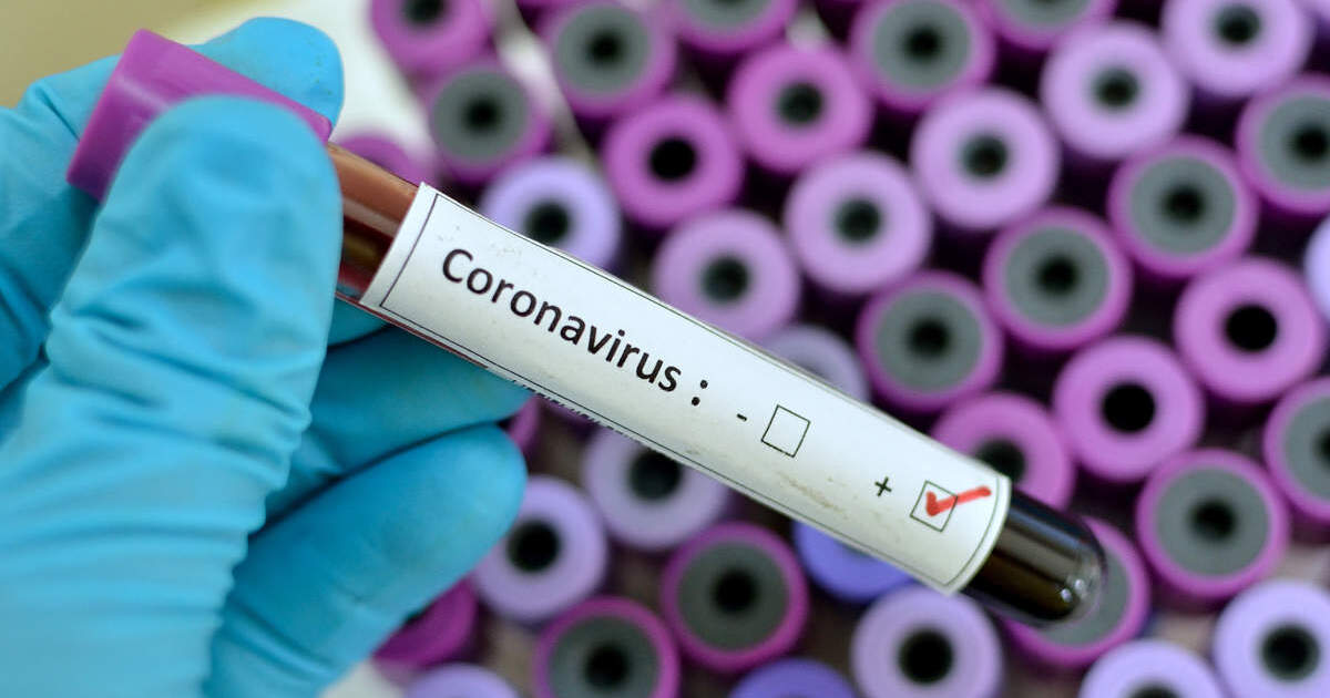 5969cef0067d05af477858841ade2c5828728d37