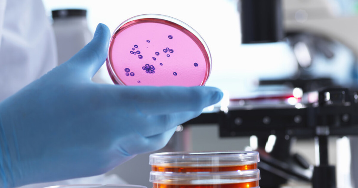 e210b76fd45ba0b33e4dc50718fec574bf9efaa1