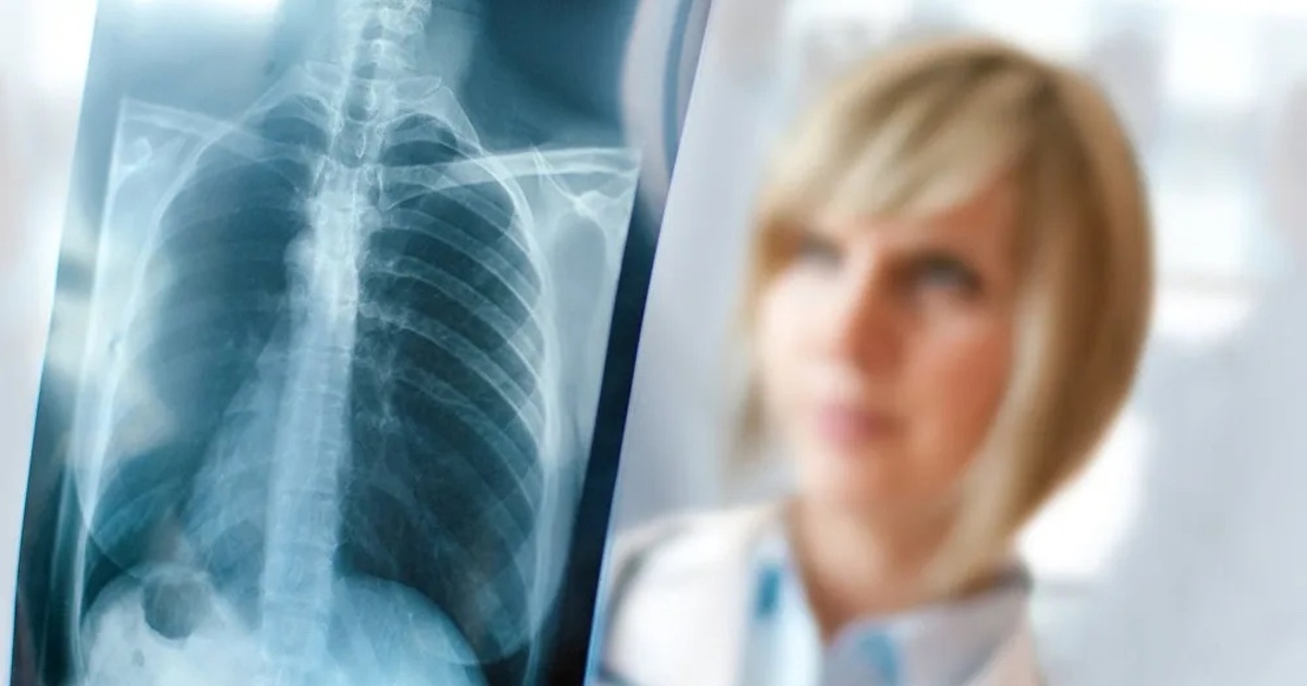 a53c8aceab401d2295b4780b3a96706e2fb3d061