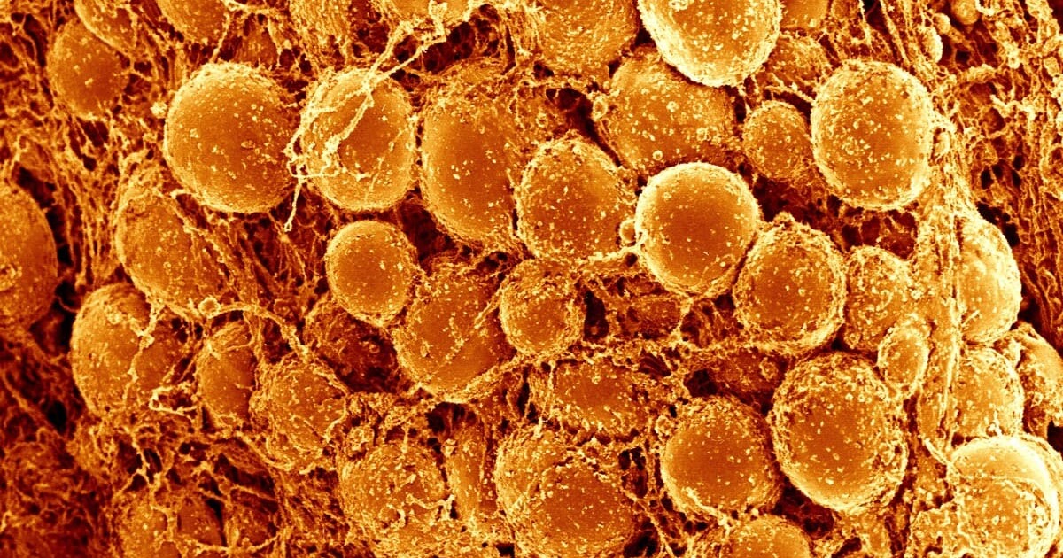 b7cd1e1538acfcd2d6a2da4ec5f22eeacca2610e