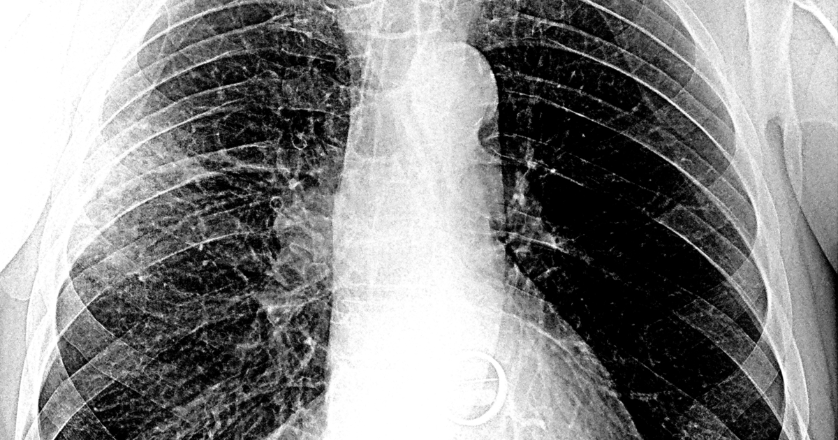 66293b19df8dc65c46101ed8e2ebcff17c45b3c1