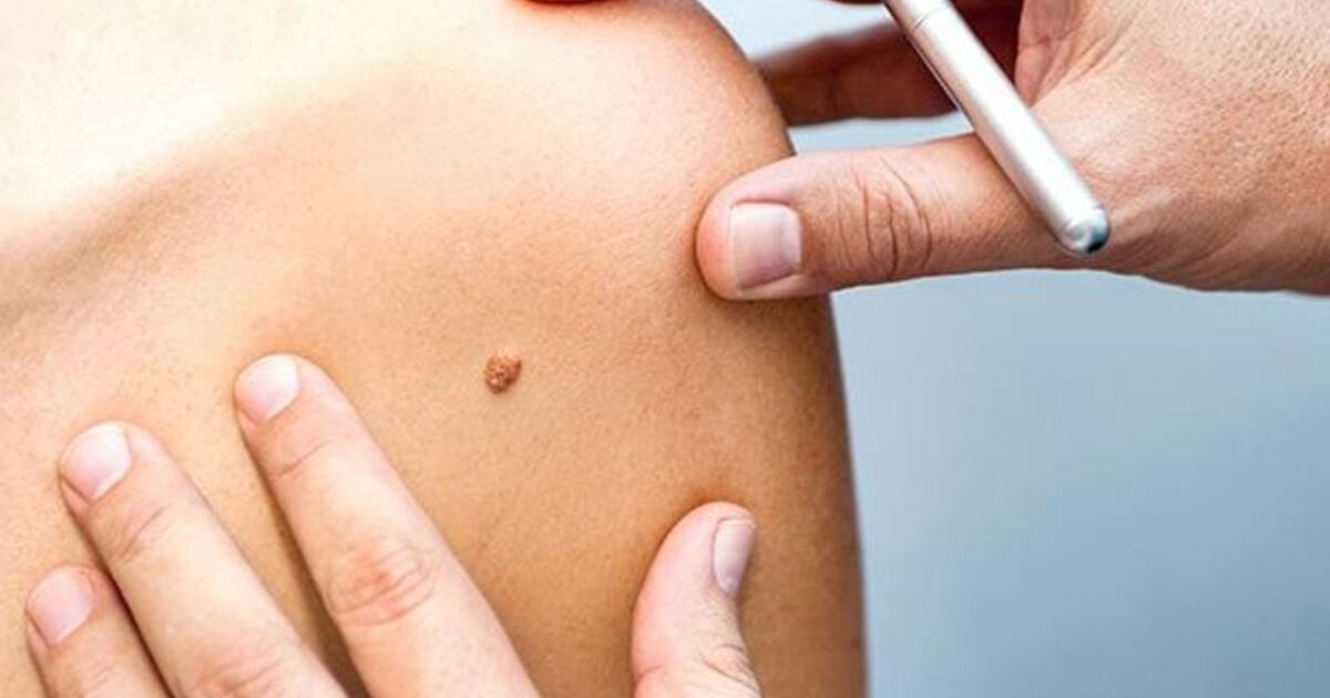 2ed0664be53dbdc230d06b9e202d934821ff4446