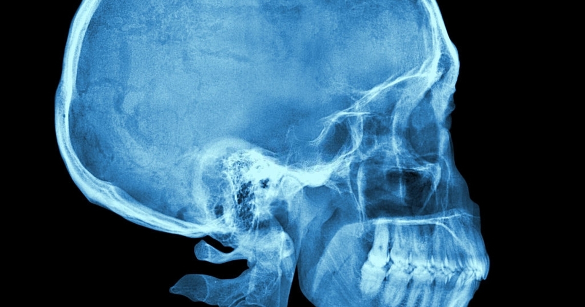 8bd1a7a0bcf64b8edf1ff8e12ac42b983e8295d2