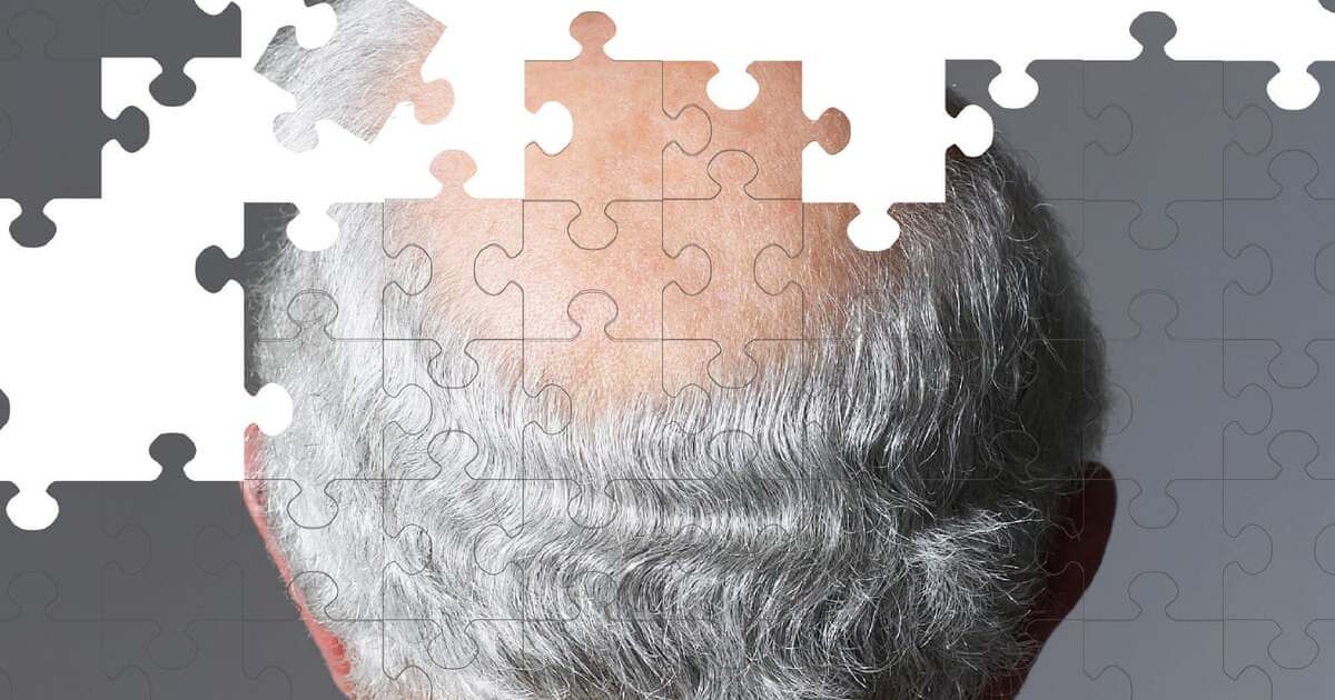Из-за какого синдрома у человека развивается болезнь Альцгеймера