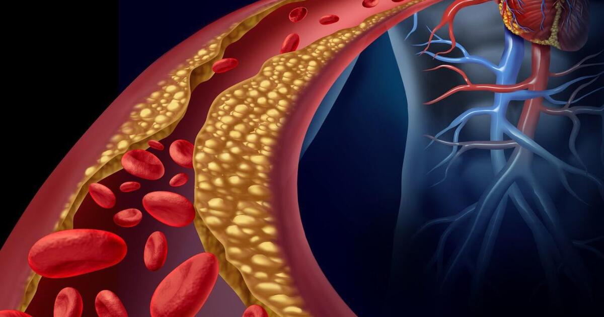 2c494367cd746b2ceea30a304447657c04423ace