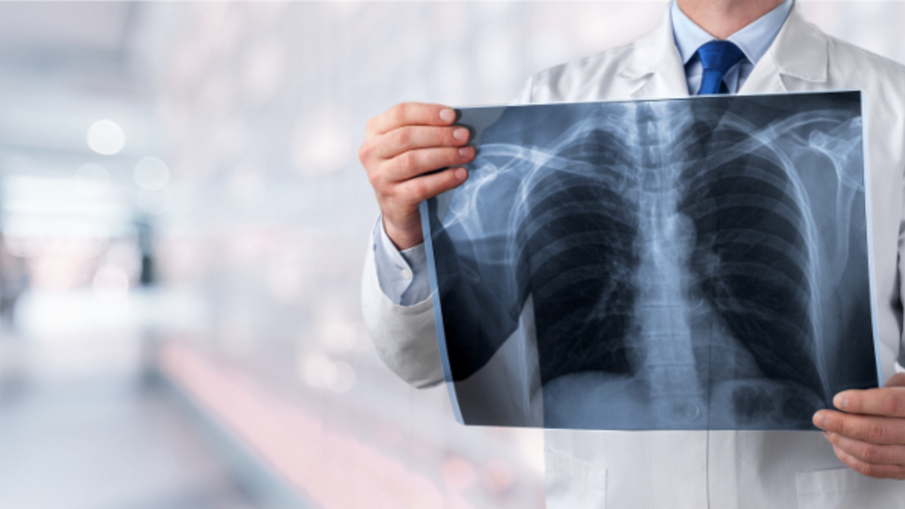 8ef0ae3b0f0daacddb40db86bce79d8f9ba55256