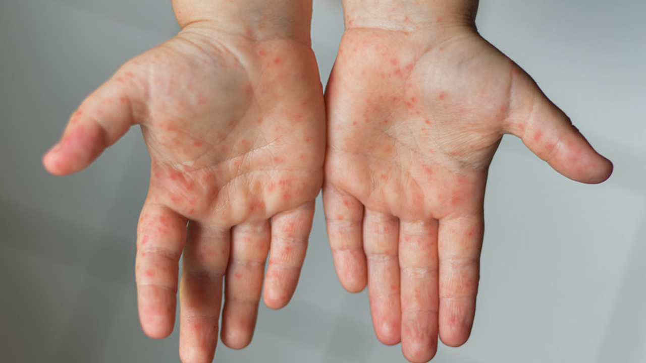 e15c191eccdd5d4d650d972d73eba12f2b870353