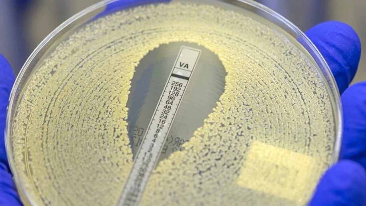 78a59f8b45906343071619a73229d541c78eff32