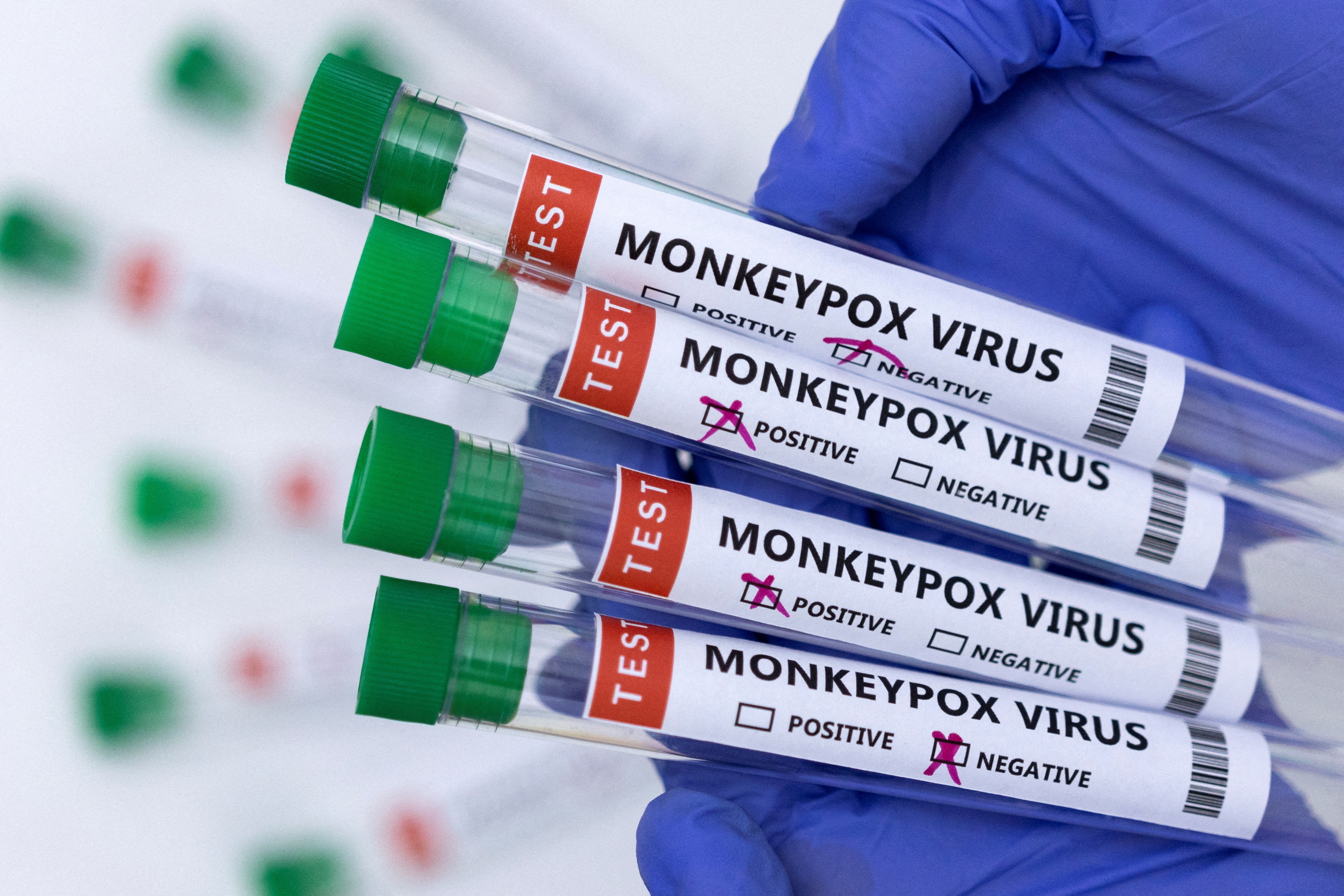 Могла ли оспа обезьян быть создана в американских биолабораториях
