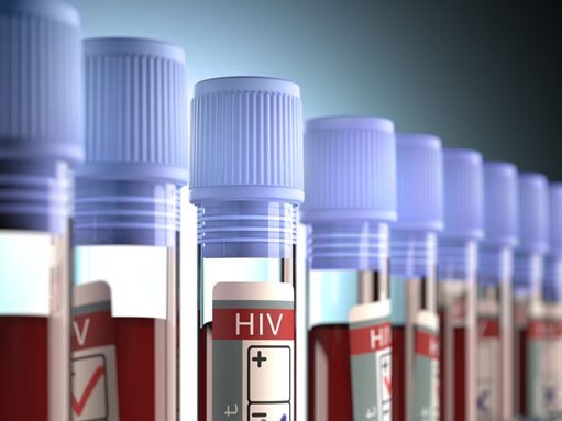 Насколько опасен новый штамм ВИЧ, обнаруженный на Кипре