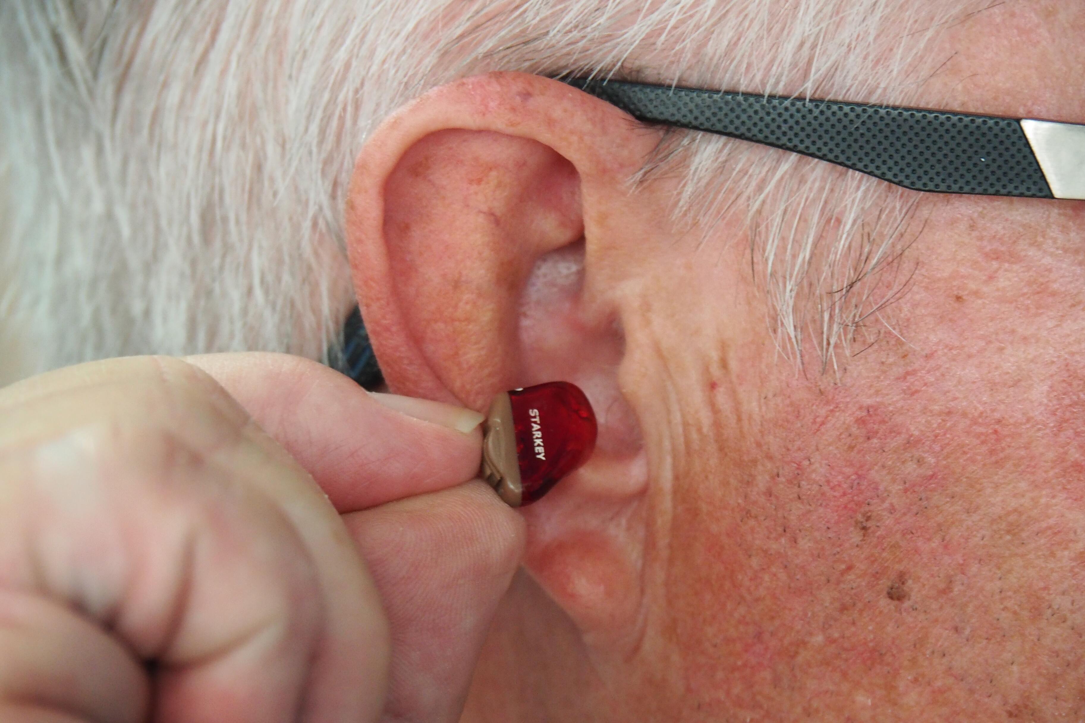 Слуховые аппараты снижают риск развития слабоумия: ученые не знают причину