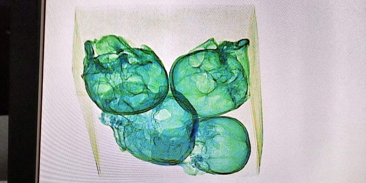 Человеческие черепа нашли в посылке, проходившей рентген в аэропорту