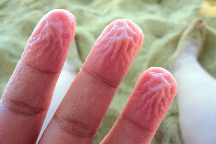 Почему после долгого нахождения в воде кожа на пальцах морщится