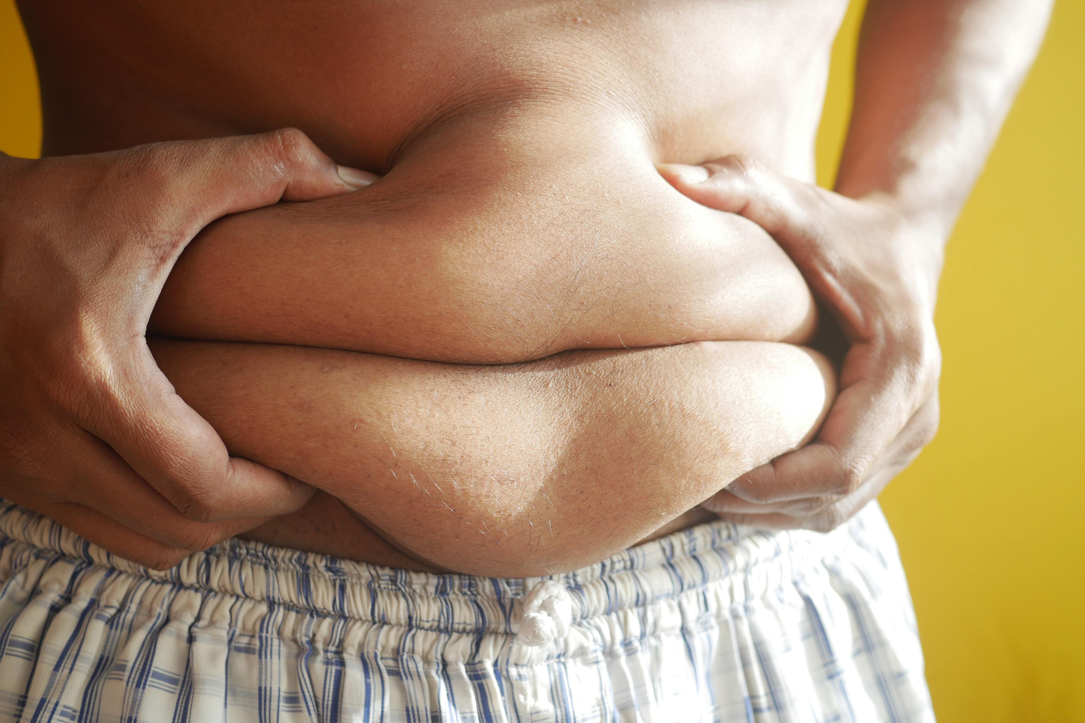 Российские учёные предупредили о резком росте ожирения после пандемии COVID-19