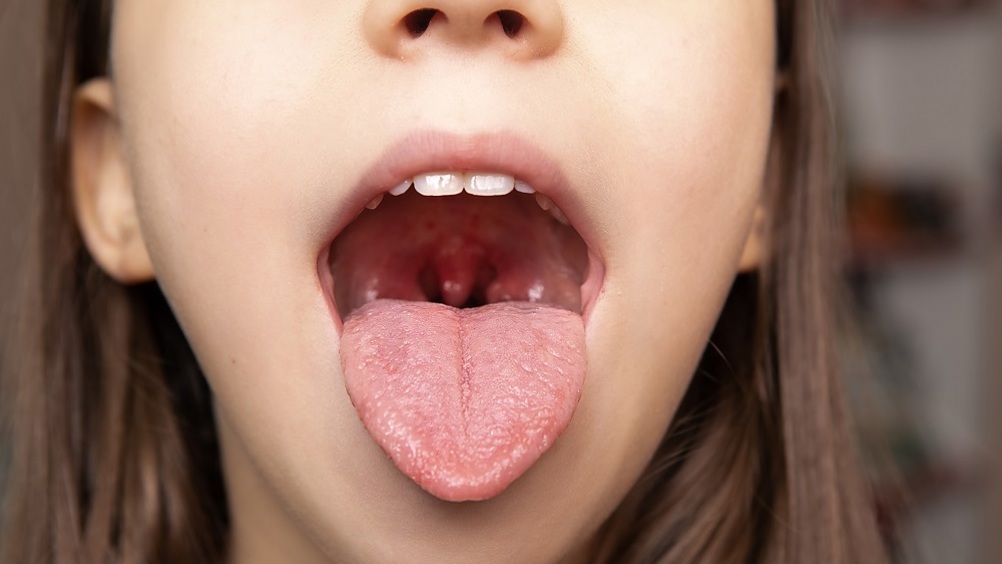 Стоматолог предупредил о самых ранних признаках рака полости рта
