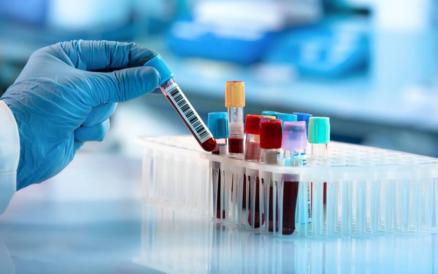 Учёный-токсиколог рассказал, как можно обнаружить болезни по анализу крови