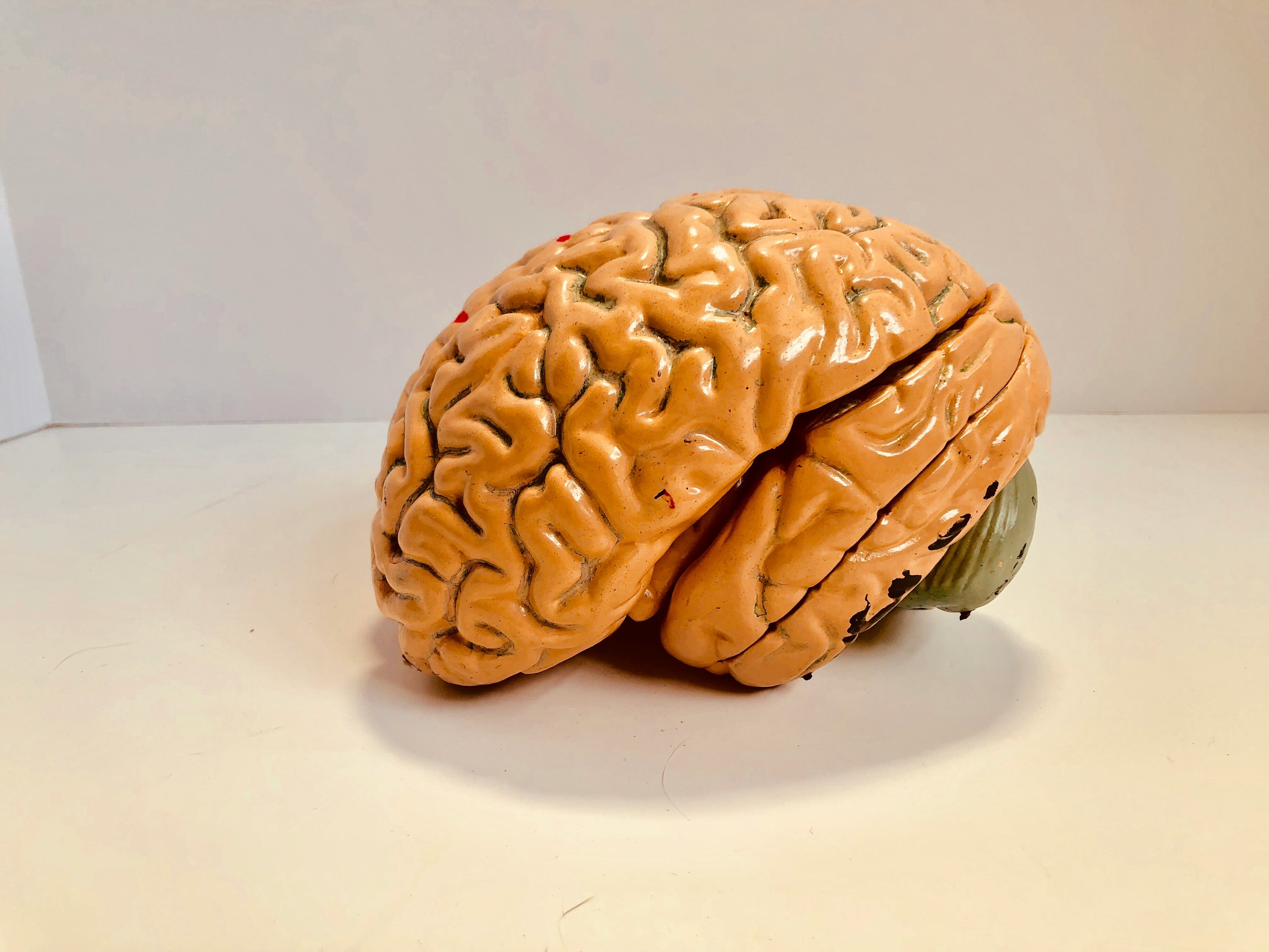 Российские учёные создали математическую модель мозга больного эпилепсией