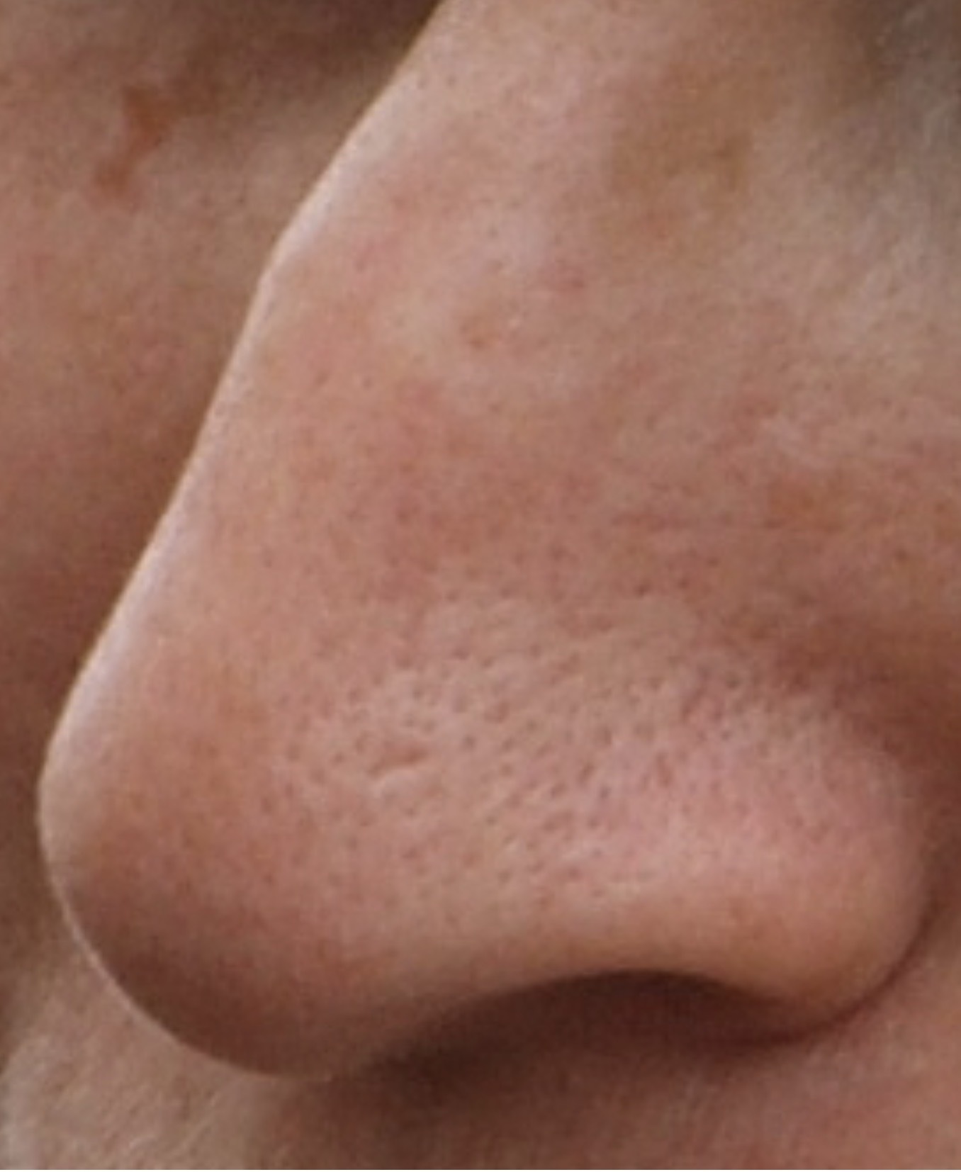 Патологоанатом рассказал об опасности ковыряния в носу