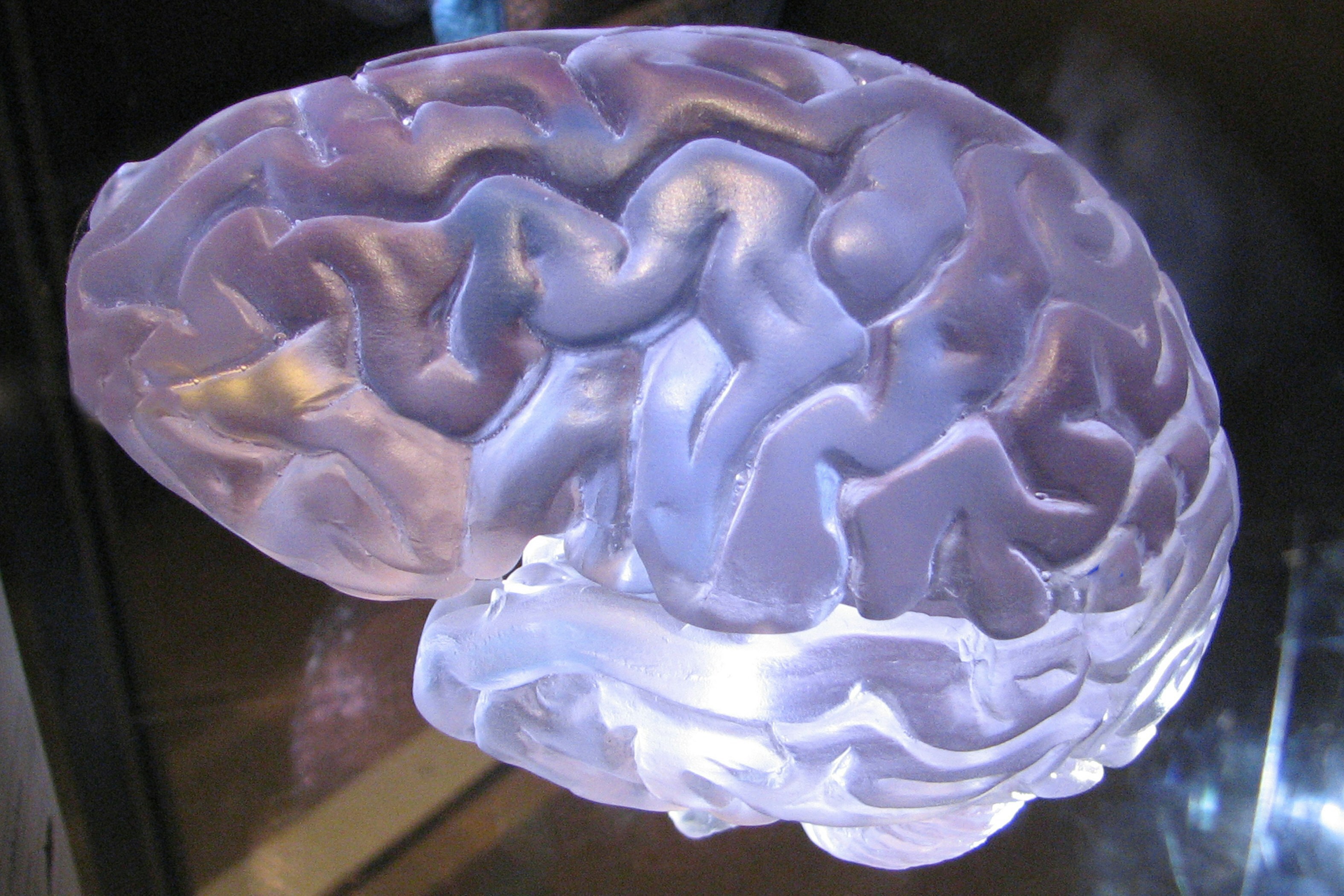 Учёные разработали математическую функцию для диагностики болезней мозга