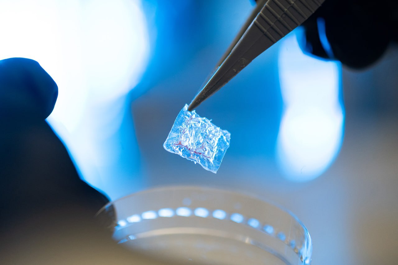 Ученые МИСИС разработали пластырь для борьбы с рецидивами рака