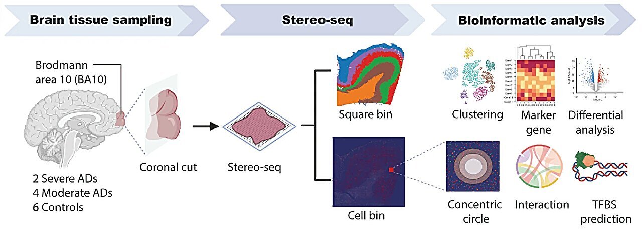 Ученые создали карту мозга, раскрывающую механизм болезни Альцгеймера 2 aa6a8e288e5fa162ba0d7ceffe1aa43cf43a4965 THE ASHGABAT TIMES