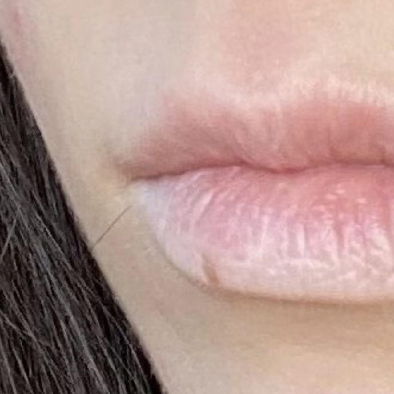 Недостаток витаминов и минералов