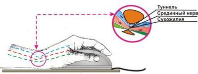 Амуниция бойца киберфронта: обзор профессиональной игровой мыши Razer Imperator