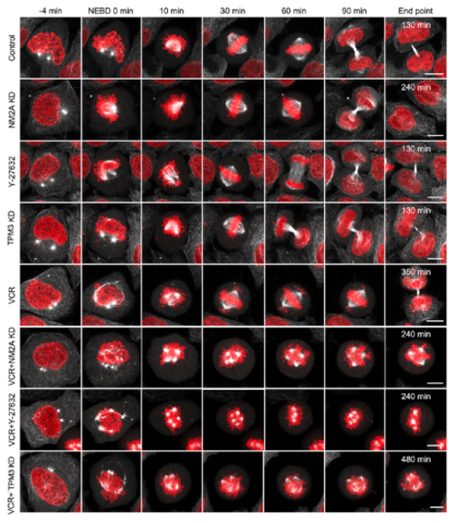 Сопротивление раковых клеток химиотерапии показали наглядно на фото