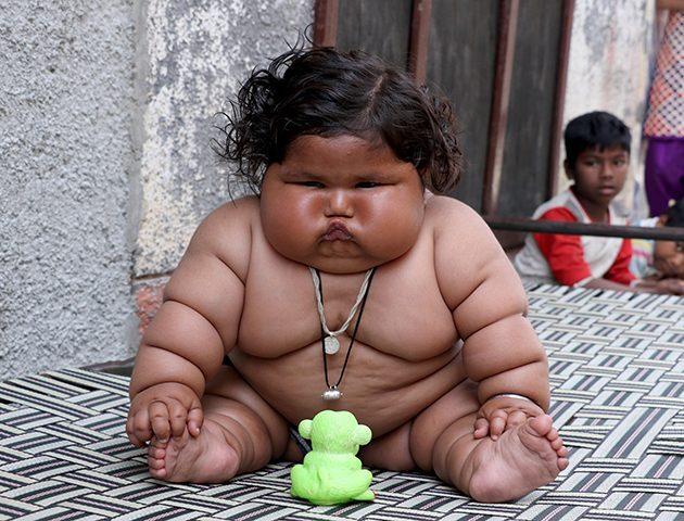 Люди с ожирением оказались более устойчивыми к определённому вирусу