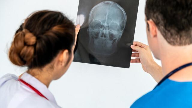 Ученые составили карту мозга после черепно-мозговой травмы