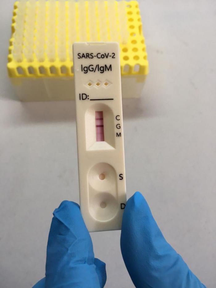 В России начнут выдавать ковидные сертификаты о перенесённом заболевании по результатам экспресс-тестов