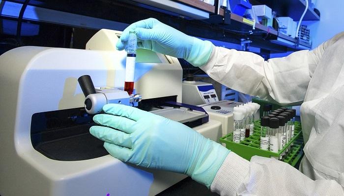 Российские медики нашли способ выявить дефицит йода у женщин