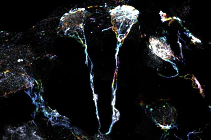 Ученые нашли новый способ активации спящих стволовых клеток мозга