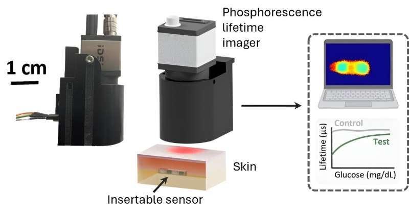 Новый сенсор для контроля уровня глюкозы улучшит диагностику диабета