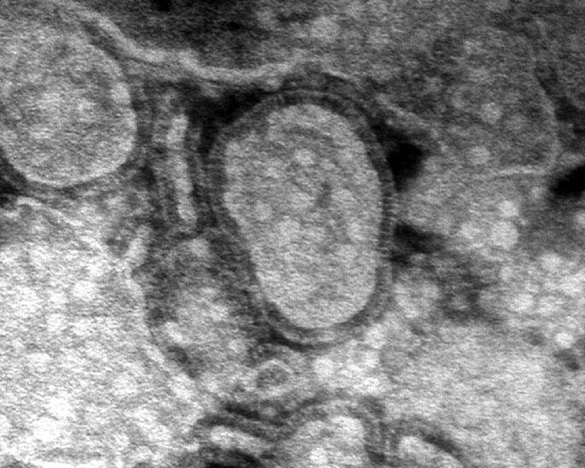 Угрожает ли миру новая пандемия из-за вируса hMPV