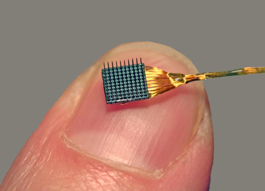 11 имплантируемых устройств, которые скоро будут у вас в теле
