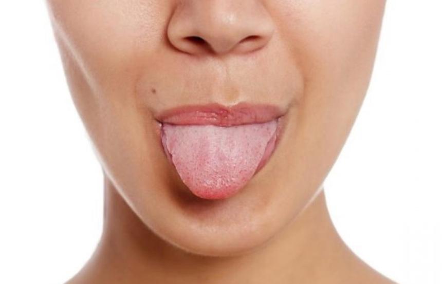 e5dbe825d473c027e9d112c6c81bbab81cb63912