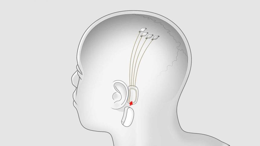 fe4ced9c171381f82284ec25ed3e101c93ae7d0c