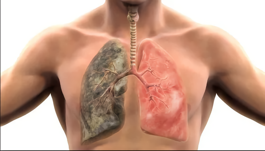 Можно ли восстановить лёгкие курильщиков