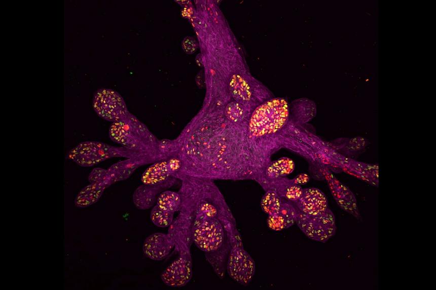 В России создали мини-лёгкие для изучения коронавируса