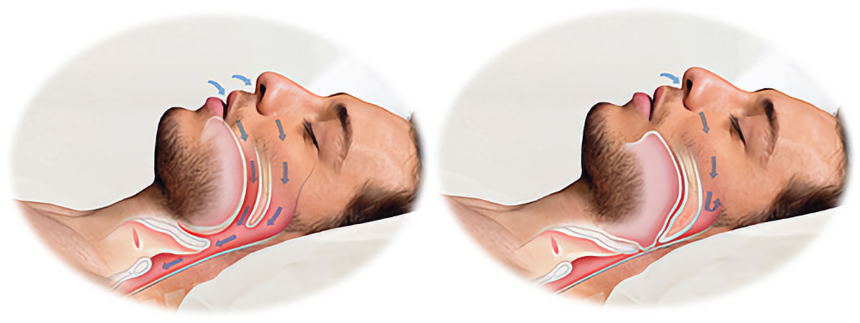 Как правильно дышать, чтобы быстрее заснуть