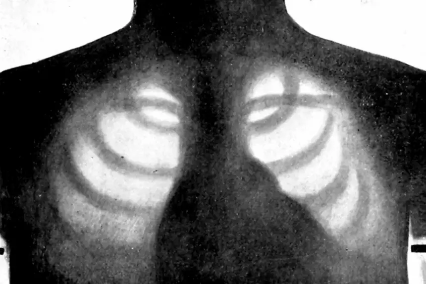 Компьютер научили делать рентген человеку самостоятельно