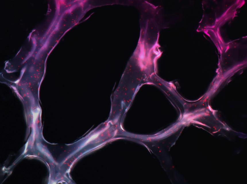 Всего одной наночастицы хватило для лечения рака