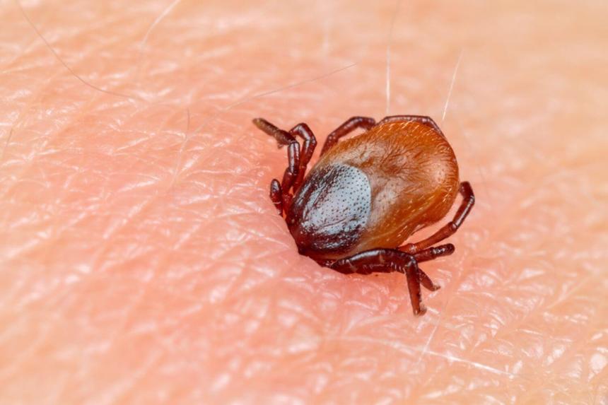 Популярный врач раскрыл порядок действий при укусе клеща