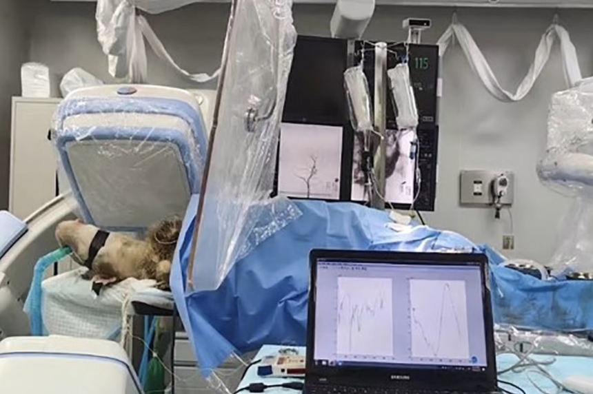 В Китае установили мозговой имплант без вскрытия черепа