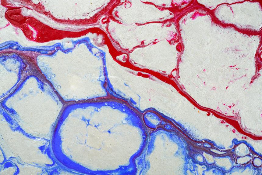 Как пережитый инсульт «бьёт» по организму