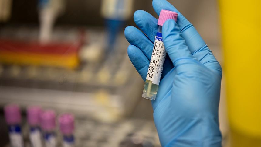 В США могут объявить чрезвычайную ситуацию из-за оспы обезьян